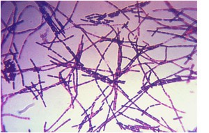 Bacily antraxu by mohly pomáhat v léčbě rakoviny. Výzkumníci jsou mírně optimističtí. Foto: Wikipedia