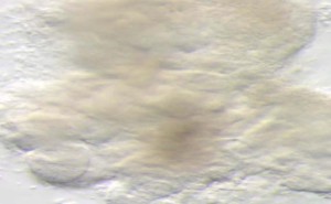 Chuchvalec na obrázku jsou miniplíce. Foto: Wikipedia