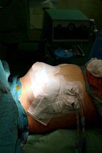 Výsledky transplantací plic jsou dnes takové, že 30 dnů po transplantaci žije 95 procent pacientů, 85 procent přežívá rok a 50 až 60 procent pět let po zákroku. Foto: FN Motol