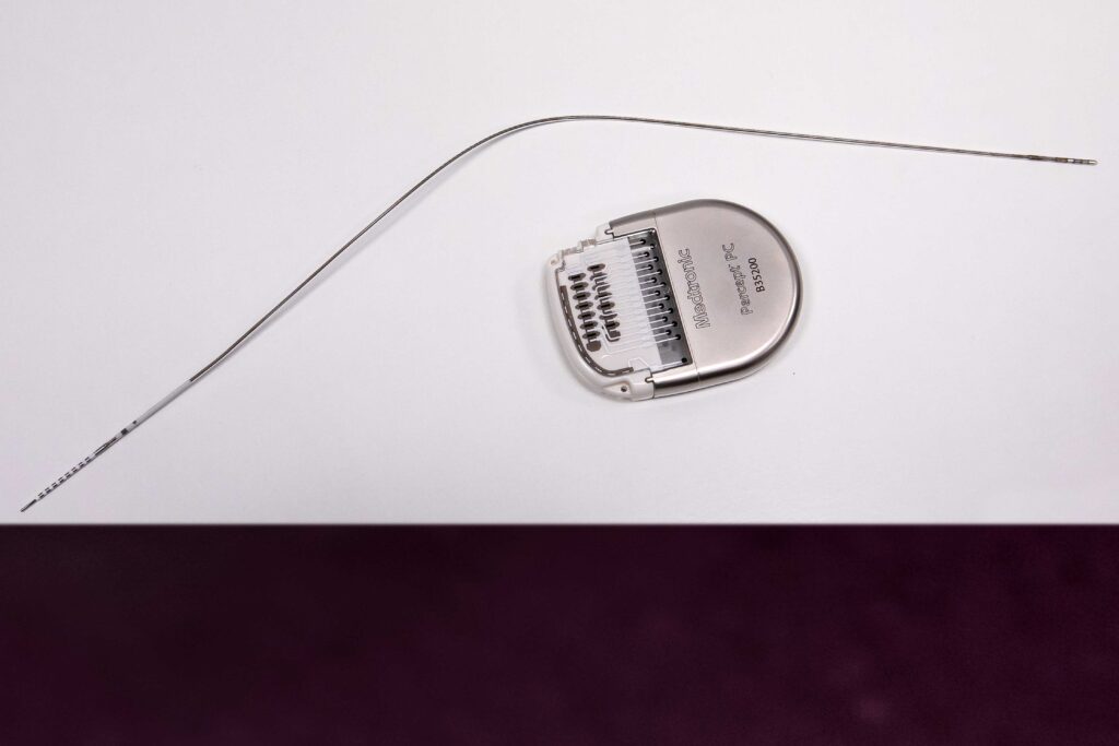 Parkinsonova choroba - adaptívna stimulácia mozgu