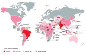 Mapa rozšíření lepry. Evropský výskyt onemocnění je z globálního hlediska zanedbatelný, v Rumunsku přesto existuje poslední leprosárium. Infografika: Leprosymission.org